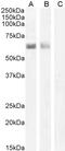 Autoimmune Regulator antibody, 45-225, ProSci, Enzyme Linked Immunosorbent Assay image 
