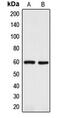 Short transient receptor potential channel 2 antibody, MBS820591, MyBioSource, Western Blot image 