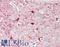 Mediator Complex Subunit 24 antibody, LS-B11072, Lifespan Biosciences, Immunohistochemistry paraffin image 