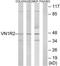 Vomeronasal 1 Receptor 2 antibody, TA316334, Origene, Western Blot image 