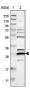 Canopy FGF Signaling Regulator 4 antibody, PA5-53130, Invitrogen Antibodies, Western Blot image 