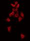 Alpha Kinase 1 antibody, GTX01077, GeneTex, Immunocytochemistry image 