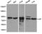 Junction Plakoglobin antibody, TA326865, Origene, Western Blot image 