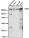 UBR5 antibody, A13816, ABclonal Technology, Western Blot image 