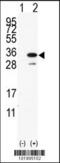 28 kDa heat- and acid-stable phosphoprotein antibody, 62-202, ProSci, Western Blot image 