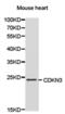 Cyclin-dependent kinase inhibitor 3 antibody, PA5-76032, Invitrogen Antibodies, Western Blot image 