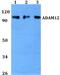 Disintegrin and metalloproteinase domain-containing protein 12 antibody, A02264, Boster Biological Technology, Western Blot image 