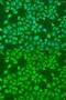 Peroxisomal acyl-coenzyme A oxidase 1 antibody, GTX32989, GeneTex, Immunocytochemistry image 