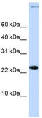 Chromatin Accessibility Complex Subunit 1 antibody, TA345217, Origene, Western Blot image 