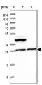 Leucine Rich Repeat Containing 73 antibody, NBP1-91736, Novus Biologicals, Western Blot image 