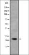 ATP Binding Cassette Subfamily C Member 6 antibody, orb338439, Biorbyt, Western Blot image 