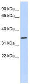 Zinc Finger Protein 660 antibody, TA341522, Origene, Western Blot image 