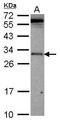 Ventral Anterior Homeobox 2 antibody, GTX115770, GeneTex, Western Blot image 