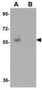 Gbp antibody, GTX31410, GeneTex, Western Blot image 