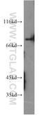 Protein Kinase C Gamma antibody, 14364-1-AP, Proteintech Group, Western Blot image 