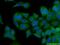Nicotinate Phosphoribosyltransferase antibody, 66159-1-Ig, Proteintech Group, Immunofluorescence image 