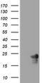 Visinin Like 1 antibody, CF802254, Origene, Western Blot image 