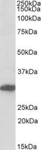 Segment polarity protein dishevelled homolog DVL-1 antibody, 43-264, ProSci, Enzyme Linked Immunosorbent Assay image 