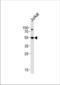 RAC-gamma serine/threonine-protein kinase antibody, TA300042, Origene, Western Blot image 