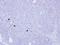 Bone Marrow Stromal Cell Antigen 1 antibody, GTX112703, GeneTex, Immunohistochemistry paraffin image 