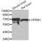 Opioid Receptor Mu 1 antibody, MBS129844, MyBioSource, Western Blot image 
