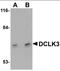 Doublecortin Like Kinase 3 antibody, orb89863, Biorbyt, Western Blot image 
