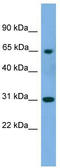 Bifunctional polynucleotide phosphatase/kinase antibody, TA340168, Origene, Western Blot image 
