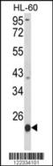 Proteasome Subunit Beta 9 antibody, 63-515, ProSci, Western Blot image 