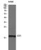 Cystatin SN antibody, GTX34332, GeneTex, Western Blot image 