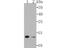 Vesicle Associated Membrane Protein 3 antibody, A02464-1, Boster Biological Technology, Western Blot image 