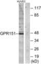 G Protein-Coupled Receptor 151 antibody, abx015257, Abbexa, Western Blot image 