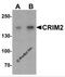 Kielin Cysteine Rich BMP Regulator antibody, 6963, ProSci Inc, Western Blot image 