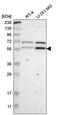 Zinc Finger Protein 230 antibody, HPA006172, Atlas Antibodies, Western Blot image 