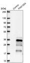 Family With Sequence Similarity 192 Member A antibody, PA5-62958, Invitrogen Antibodies, Western Blot image 