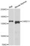 Caspase recruitment domain-containing protein 11 antibody, AHP2445, Bio-Rad (formerly AbD Serotec) , Western Blot image 
