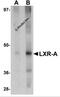 Nuclear Receptor Subfamily 1 Group H Member 3 antibody, 5577, ProSci Inc, Western Blot image 