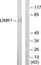 LIM Domain Kinase 1 antibody, TA311985, Origene, Western Blot image 