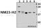 NME/NM23 Nucleoside Diphosphate Kinase 2 antibody, GTX66869, GeneTex, Western Blot image 