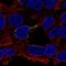 Ethylmalonyl-CoA Decarboxylase 1 antibody, HPA035446, Atlas Antibodies, Immunocytochemistry image 
