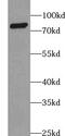 ATP Binding Cassette Subfamily D Member 2 antibody, FNab00038, FineTest, Western Blot image 
