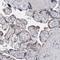 Perilipin A antibody, HPA024299, Atlas Antibodies, Immunohistochemistry frozen image 