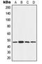 Angio-associated migratory cell protein antibody, LS-C351777, Lifespan Biosciences, Western Blot image 