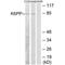 Phosphofructokinase, Platelet antibody, PA5-49819, Invitrogen Antibodies, Western Blot image 