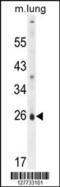 Solute Carrier Family 66 Member 2 antibody, 55-478, ProSci, Western Blot image 