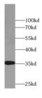 Cytochrome B5 Reductase 3 antibody, FNab02117, FineTest, Western Blot image 