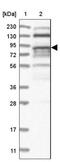 Zinc Finger Protein 227 antibody, NBP1-85930, Novus Biologicals, Western Blot image 