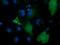 Peroxisomal trans-2-enoyl-CoA reductase antibody, MA5-25262, Invitrogen Antibodies, Immunocytochemistry image 
