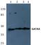 GATA Binding Protein 4 antibody, AP06693PU-N, Origene, Western Blot image 