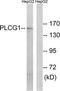 Phospholipase C-gamma-1 antibody, TA313086, Origene, Western Blot image 