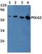 DNA Polymerase Gamma 2, Accessory Subunit antibody, PA5-75881, Invitrogen Antibodies, Western Blot image 